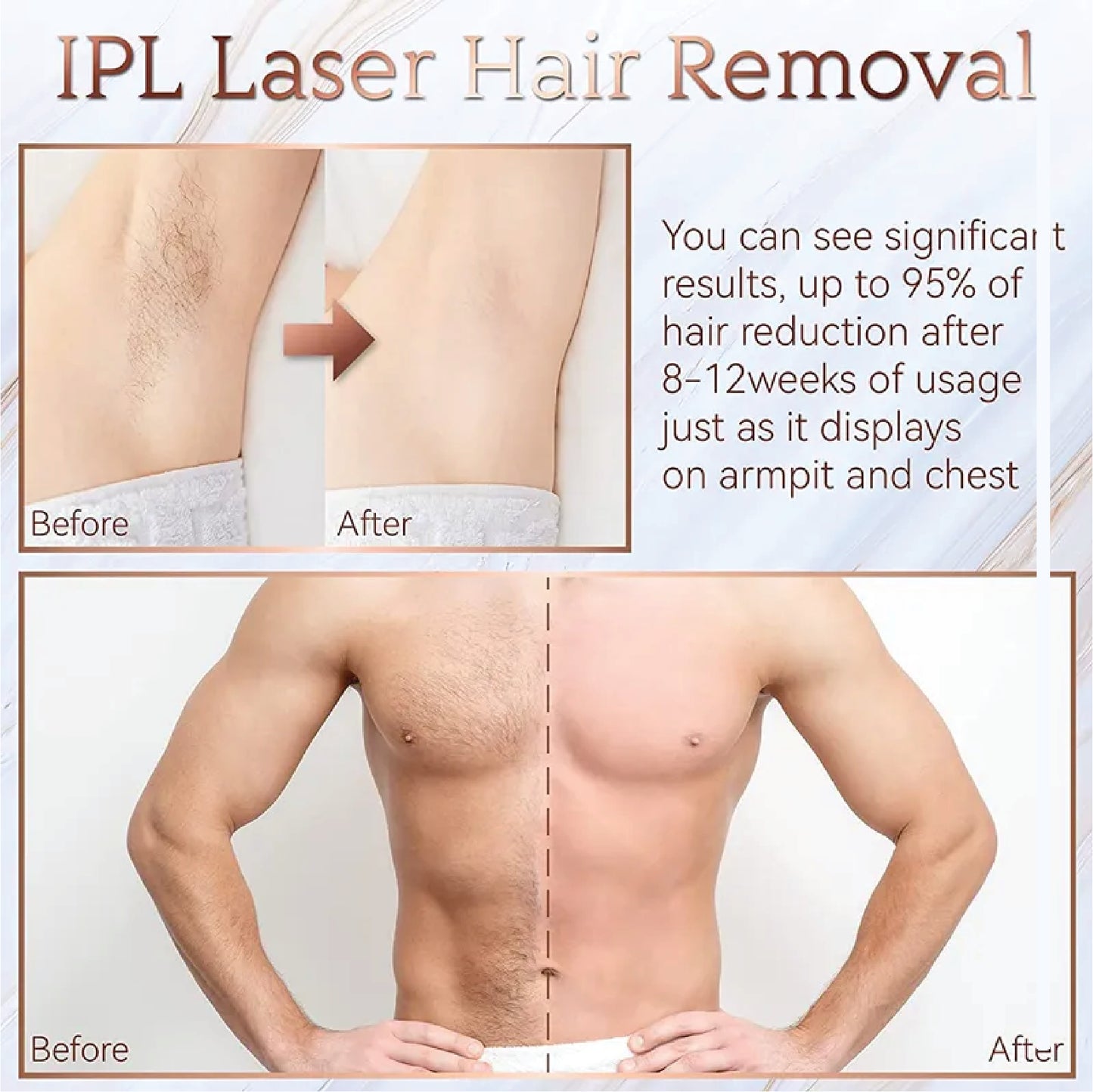 DYI Flashes IPL Hair Removal